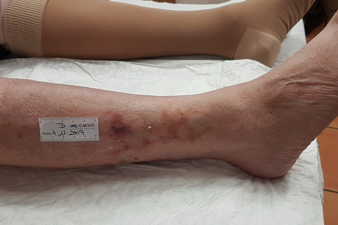 valoracion inicial martorell 01