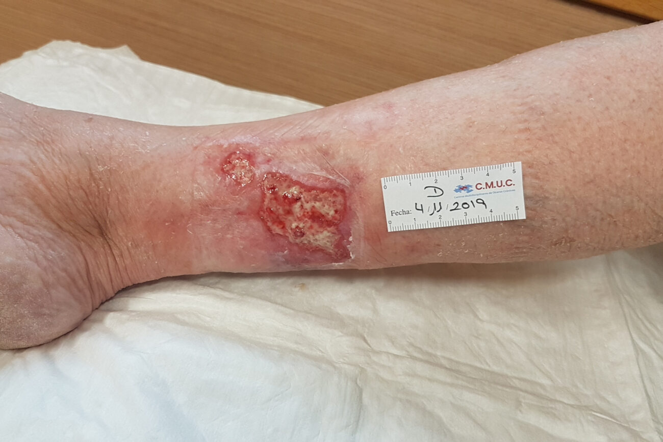 valoracion inicial martorell 02